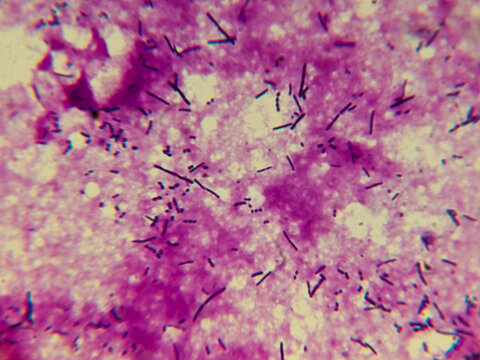  Lactobacillus Gram-Stained Bacteria Rods Under Microscope