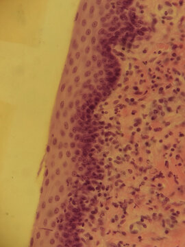 Human Esophagus Cross Section Histology Hematoxylin Eosin
