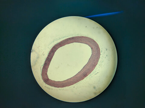 Aorta Large Artery Cross Section Histology Showing Tunica Layers