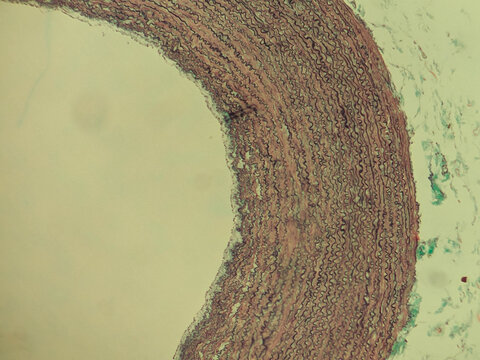Aorta Large Artery Cross Section Histology Showing Tunica Layers