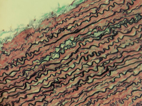 Aorta Large Artery Cross Section Histology Showing Tunica Layers