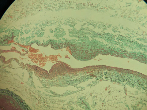 Muscular Artery Cross Section Verhoeff Van Gieson Elastic Stain Histology M