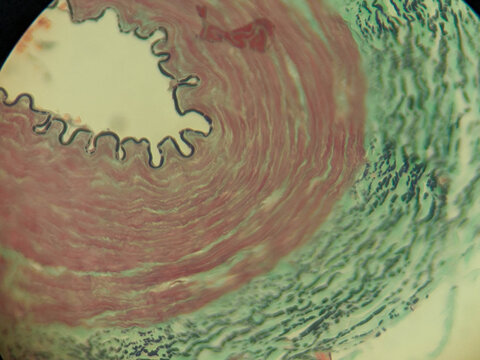 Muscular Artery Cross Section Verhoeff Van Gieson Elastic Stain Histology M