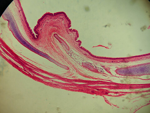 Pseudostratified Ciliated Columnar Epithelium Human Respiratory Tract Histology