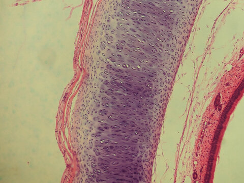 Pseudostratified Ciliated Columnar Epithelium Human Respiratory Tract Histology