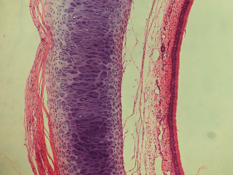 Pseudostratified Ciliated Columnar Epithelium Human Respiratory Tract Histology