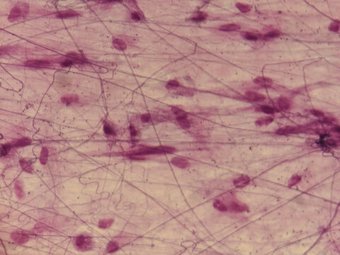  Loose Connective Tissue Fibroblasts Collagen Fibers Histology