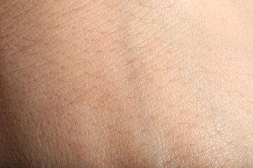 Fototapeta premium Texture of normal skin as background, closeup