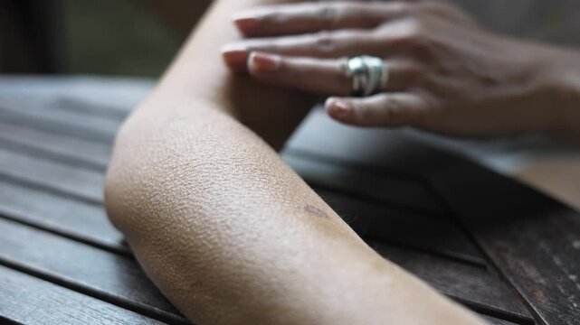 A woman arm with goose bumps on skin is resting on a wooden table