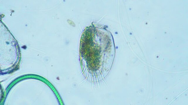 Protozoa microorganism cell movement under light microscope representing aquatic protozoology study and live evolutionary biology research in 4K Ultra HD footage