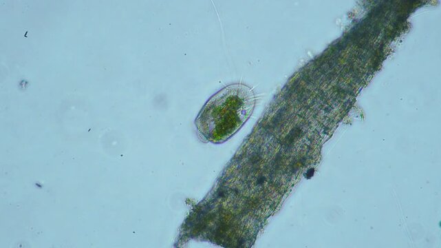 Protozoa microorganism cell movement under light microscope representing aquatic protozoology study and live evolutionary biology research in 4K Ultra HD footage