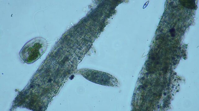 Protozoa microorganism cell movement under light microscope representing aquatic protozoology study and live evolutionary biology research in 4K Ultra HD footage

