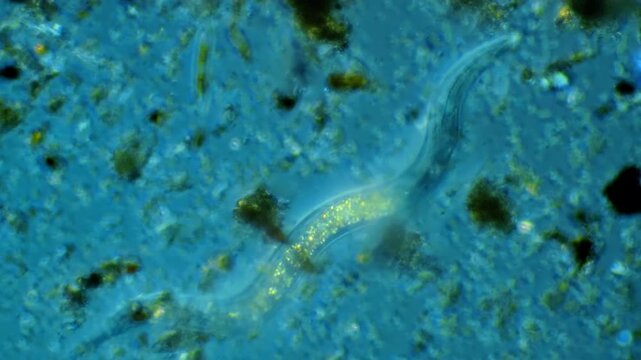 Nematode microorganism movement under light microscope representing soil microbiome ecology and parasitic roundworm science research in 4K Ultra HD footage
