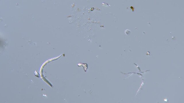 Nematode worm microorganism locomotion under light microscope representing cellular chemotaxis assays and neurobiology behavioral science research in 4K Ultra HD footage
