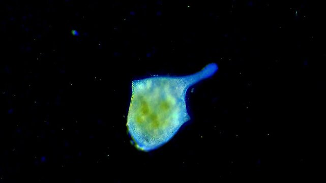 Stentor micro organism swimming under light microscope representing trumpet ciliate morphology and aquatic protozoology ecology research in 4K Ultra HD footage
