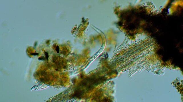 Microscopy of nematode microorganism movement representing soil microbiome ecology and parasitic roundworm science research in 4K Ultra HD footage
