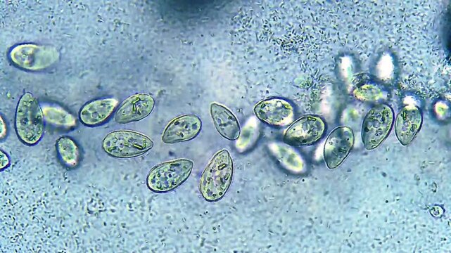 Ciliates and bacteria micro organisms interaction under light microscope representing protozoa bacteria grazing kinetics and microbial ecology research in 4K Ultra HD footage
