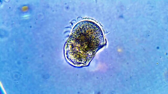 Urocentrum turbo microorganism swimming under light microscope representing helical swimming biokinetics and hymenostomatida ciliate ecology research in 4K Ultra HD footage
