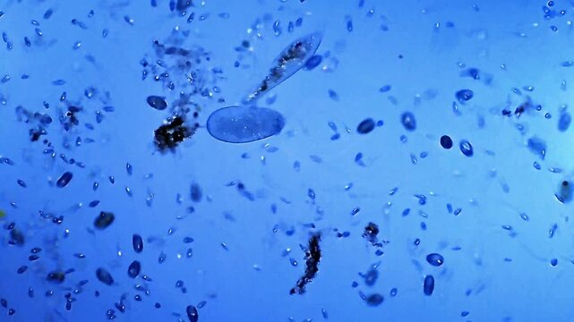Ciliates micro organisms colony swimming under light microscope representing colonial ciliophora behavior and aquatic microbial aggregate research in 4K Ultra HD footage
