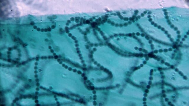 Beads algal under light microscope representing immobilized microalgae culture and photosynthesis biochemical reaction study in 4K Ultra HD footage
