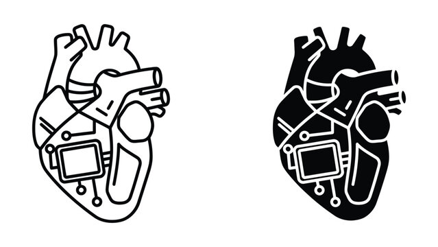 Pacemaker implanted in human heart illustration