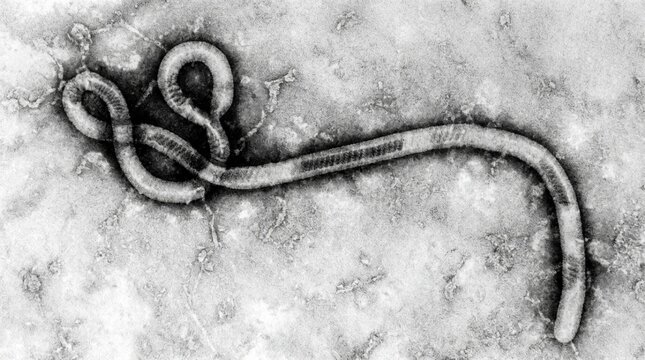 Ebola virus under transmission electron microscope
