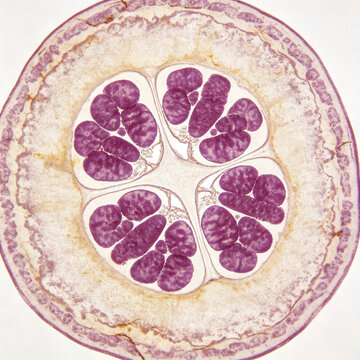 Micrographs of onion root tip cells undergoing metaphase of mitosis stained with acetocarmine, showing chromosome condensation staining.