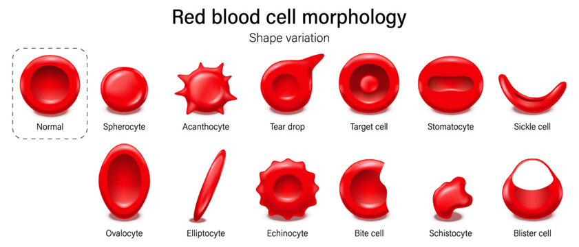 Shape variation of red blood cell morphology. Normal and abnormal erythrocytes. Hematological abnormalities.