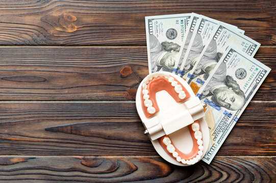 Closeup model of a human jaw with white teeth and dollar bill. Dentistry conceptual photo. Prosthetic dentistry. False teet top view with copy space