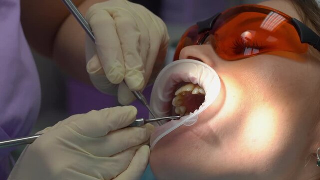 Young woman in dental glasses visits an orthodontist. Dentist sucks the patient's saliva with a saliva pump. Oral hygiene