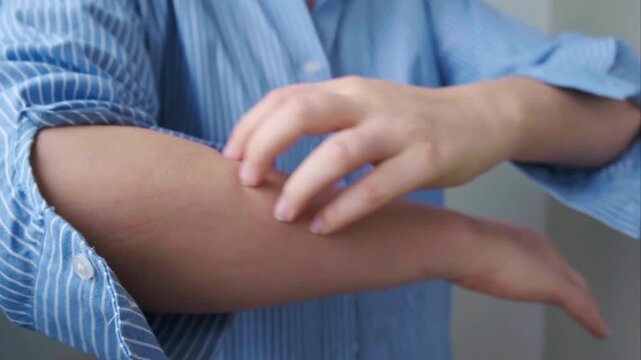 Close up of hand scratching skin early signs of food allergy redness and swelling.