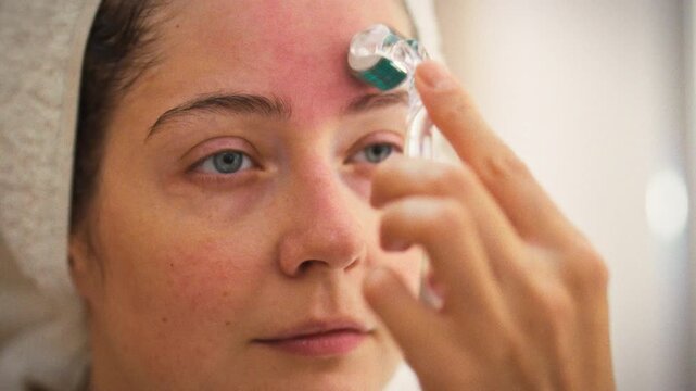 In a bathroom, a young woman in a white robe with a towel on her head uses a Derma Roller for microneedling, focusing on skincare and facial treatment to improve skin tone and texture