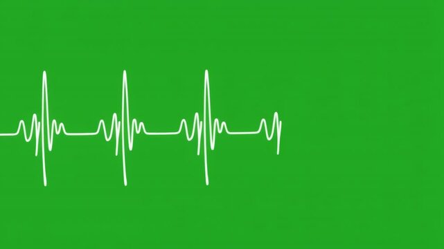Animated heartbeat line on green screen background for medical or health related videos