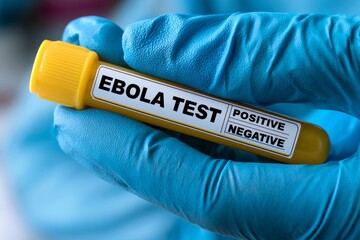 Obraz premium Medical Professional Holding Ebola Test Tube with Positive Negative Result Options