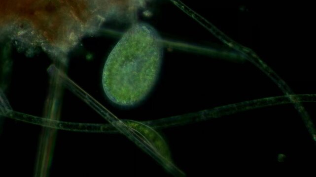 Paramecium bursaria at 20x under darkfield microscopy