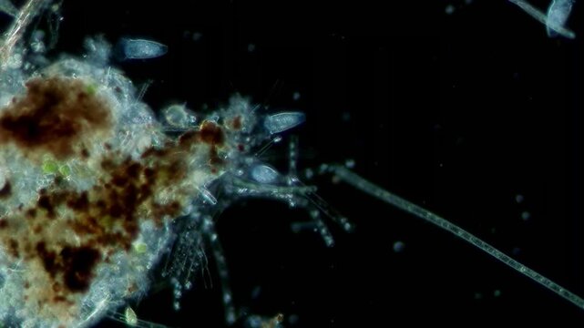 Peritrich ciliate at 10x under darkfield microscopy