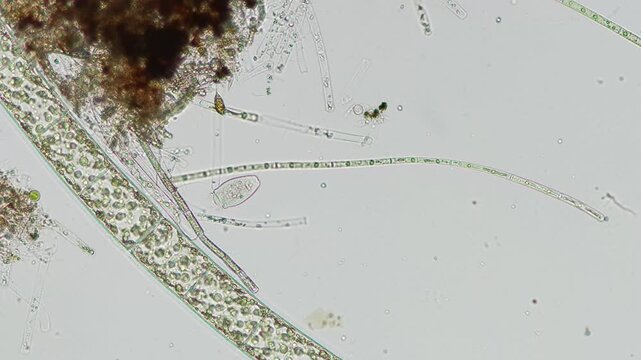 Peritrich ciliate at 10x under brightfield microscopy