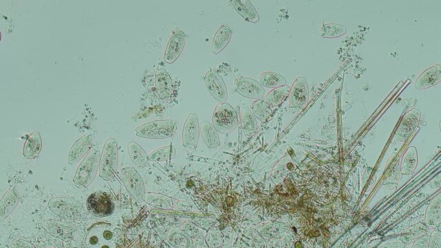 Peritrich ciliate at 20x under brightfield microscopy