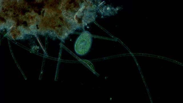 Paramecium bursaria at 10x under darkfield microscopy