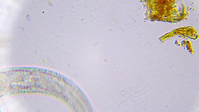 Nematode roundworm moving under light microscope at 400x magnification in brightfield illumination