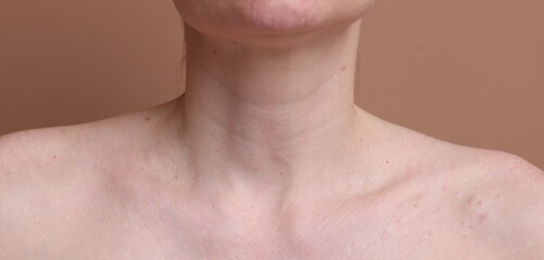 Naklejka premium Woman with beautiful skin on beige background, closeup