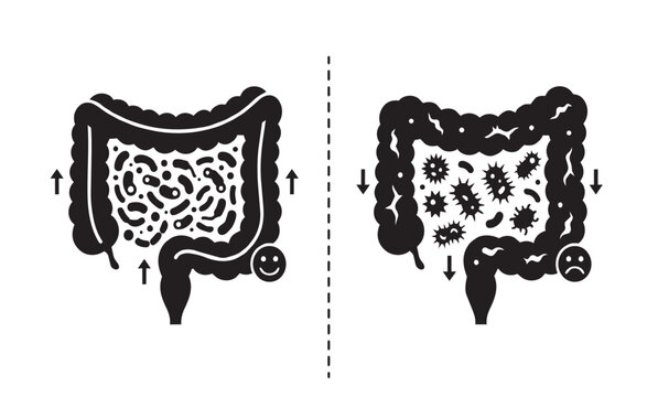 Gut microbiota balance comparison vector illustration showing healthy versus unhealthy intestine bacteria