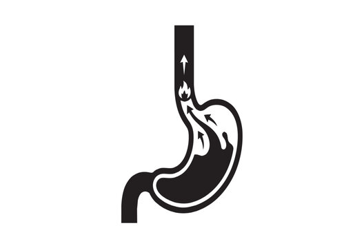 Medical vector icon demonstrating stomach acid reflux into the esophagus. Heartburn and gastroesophageal reflux disease (GERD) concept isolated on white.