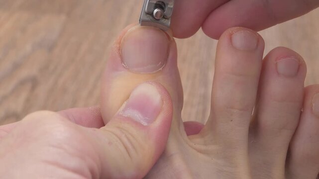 Man cuts his toenail using a nail clipper. Foot and toes of an adult man, close-up shot video
