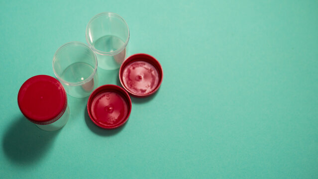 Three sterile medical specimen containers with red lids on blue background