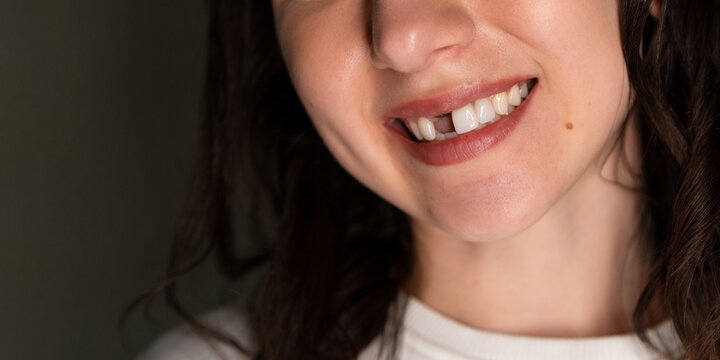 Emotional woman shows smile and missing front tooth due to dental issue while standing alone in a dimly lit room