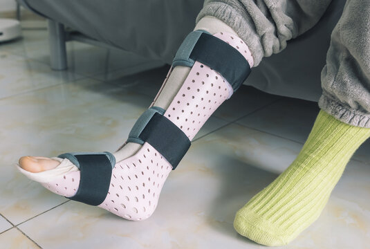 Person's lower leg fitted with a light pink perforated medical brace for injury recovery.