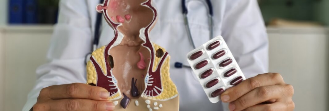 Doctor explains treatment options using anatomical model and medication