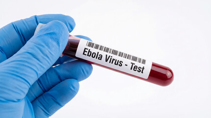 Obraz premium ebola virus test in blood sample tube held by gloved hand