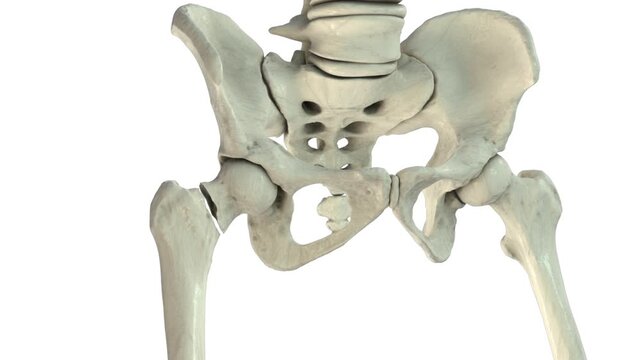 Femoral neck fracture with displacement, rotating 3D animation showing cortical and trabecular bone disruption. Orthopedic visualization of proximal femur injury and fracture alignment.